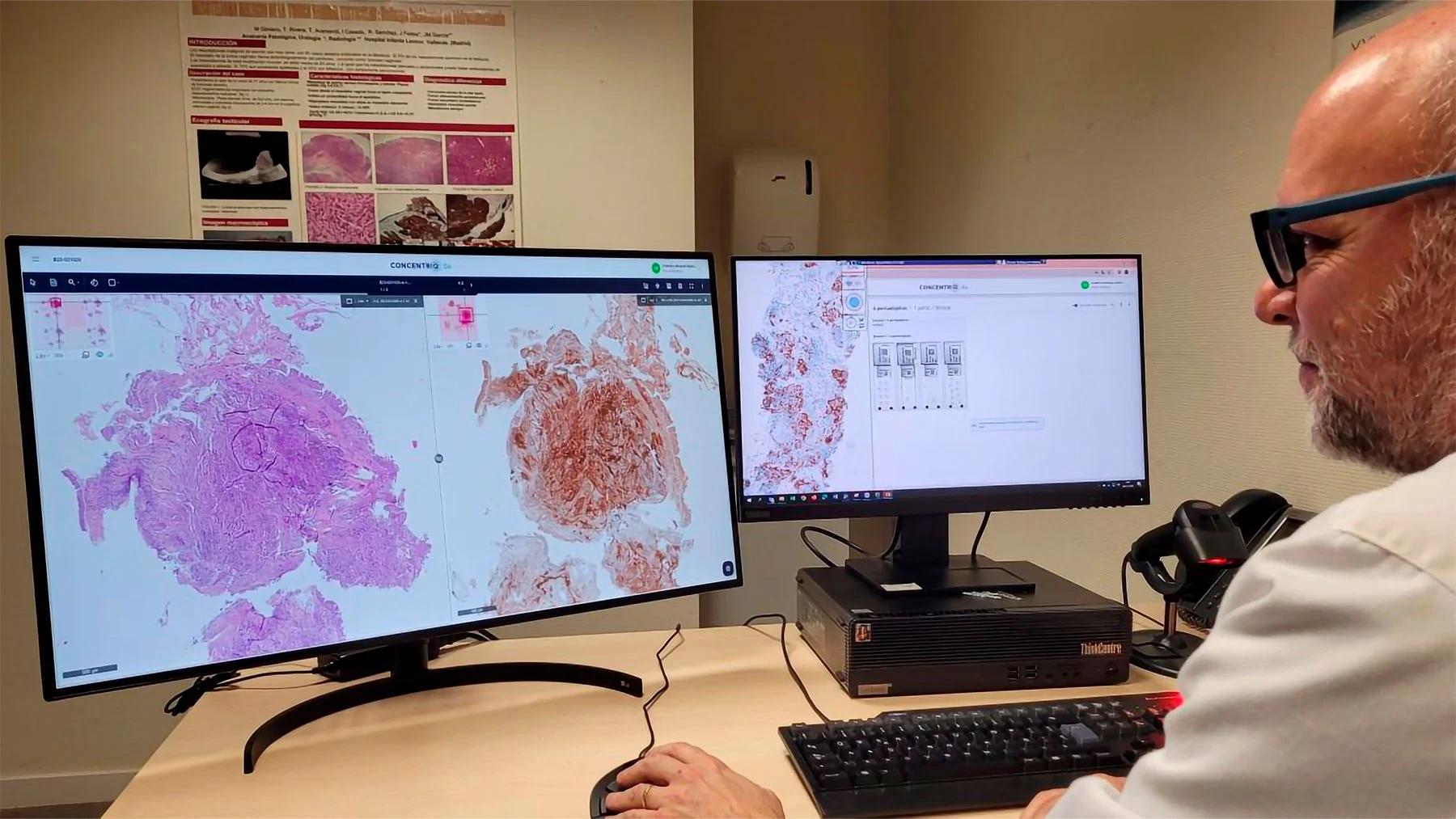 El Hospital Universitario Infanta Leonor estrena un Nuevo Sistema de Patología Digital Completo