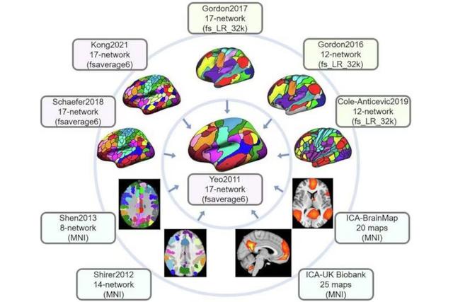 Neurocientíficos crean un “traductor” digital para mejorar los estudios cerebrales